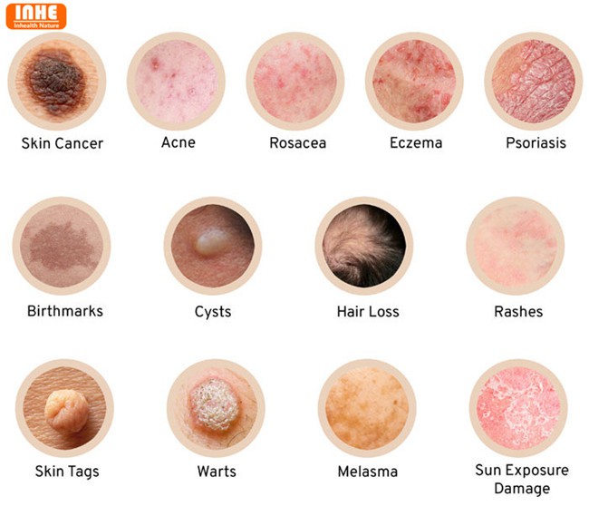 Skin Problems